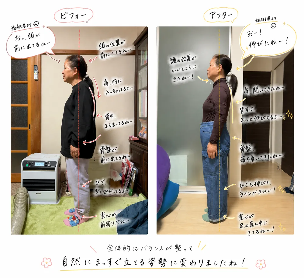 姿勢チェックのビフォーアフター